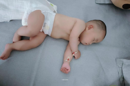 新安六个月宝宝眼睛散光